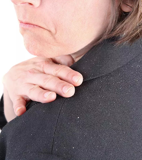 How To Prevent Dandruff In Winter?