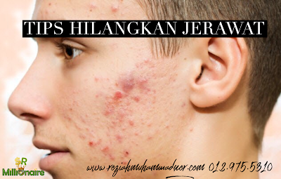 tips hilangkan jerawat