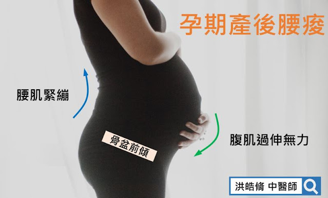 懷孕期與產後腰痠,骨盆歪斜