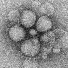 Schools And Hospitals In San Pedro, Laguna Are Affected By MERS- CoV Virus Scare