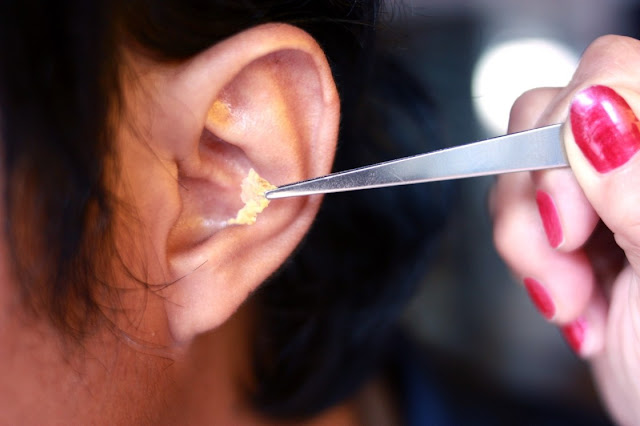 Expert ear wax removal for clear hearing