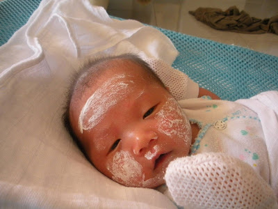 heat rashes on face. newborn heat rash on face.