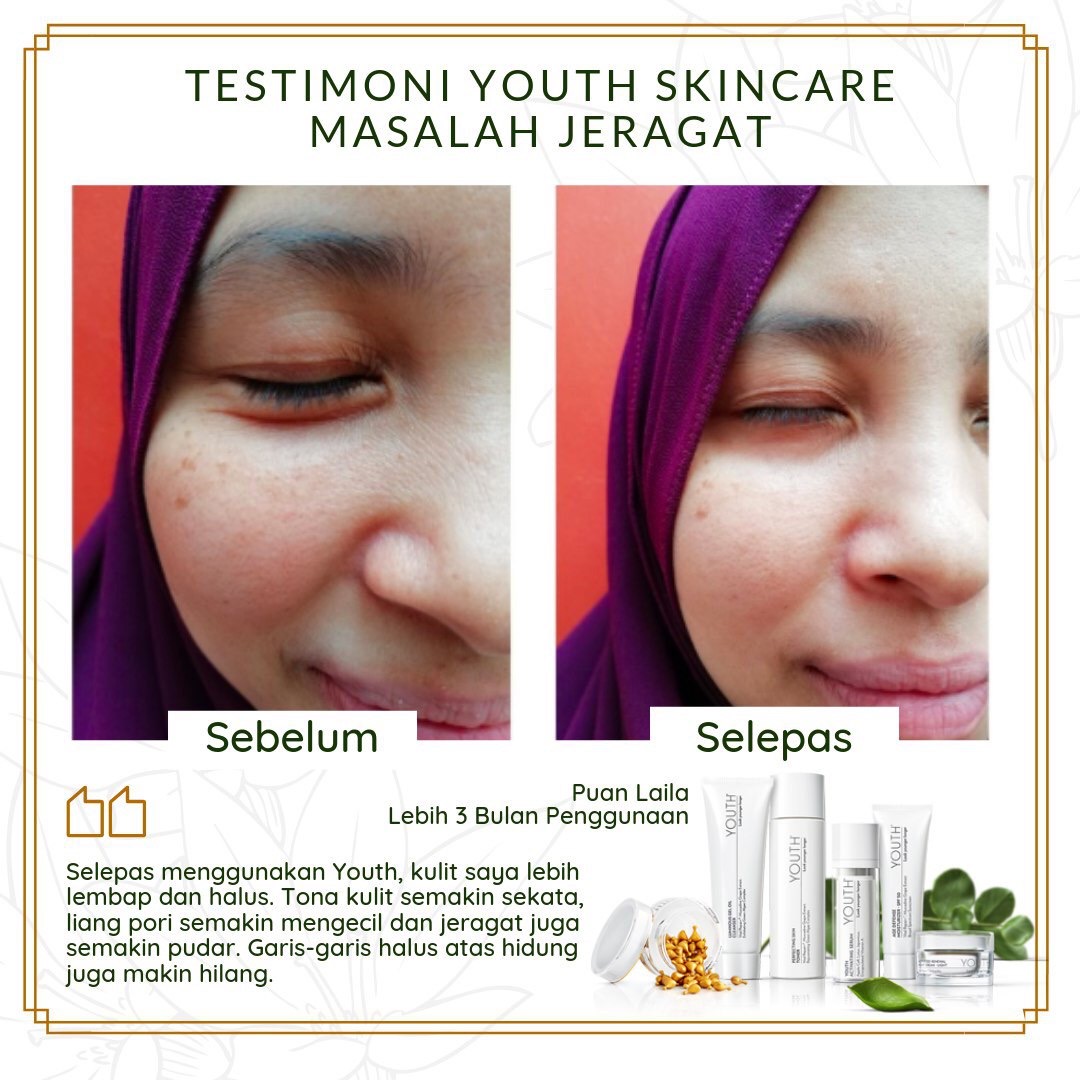 Testimoni YOUTH Skincare Shaklee