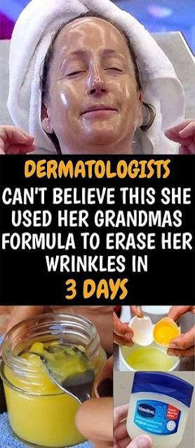 Dermatologists Can’t Believe This She Used Her Grandma’s Formula To Erase Her Wrinkles In Three Days