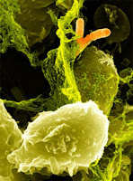 Caption: Fig. 1: Neutrophil granulocytes have trapped Shigella bacteria in NETs. Credit: Dr. Volker Brinkmann, Max Planck Institute for Infection Biology, Usage Restrictions: None.