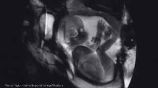 Resultado de imagem para feto humano gif
