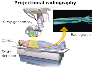 Radyografi