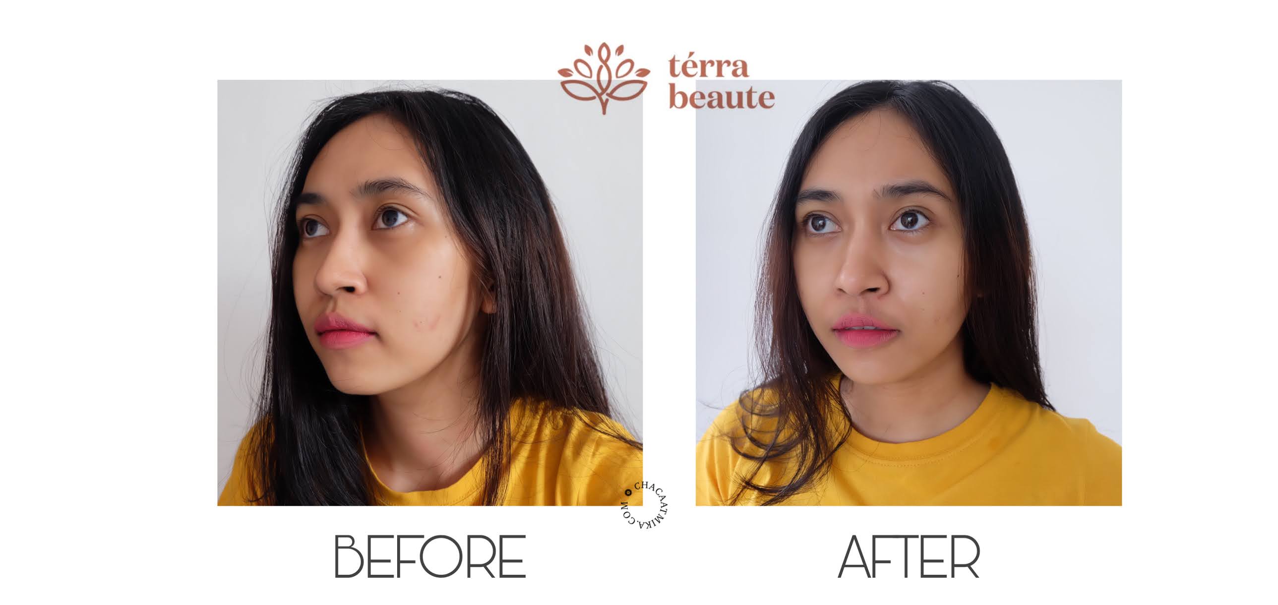 Before After Penggunaan Terra Beaute Skin Care