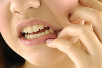 Cara mengobati sakit gigi secara alami | widadaraharja.blogspot.com