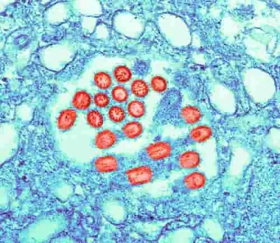 A micrografia eletrônica de transmissão (TEM) revelou a presença de uma série de novos vírions do vírus H1N1 (vermelho) nesta amostra de cultura de tecido.