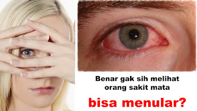 Benar gak sih melihat orang sakit mata bisa menular 