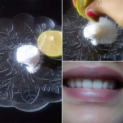 Cara Murah dan Mudah Putihkan Gigi
