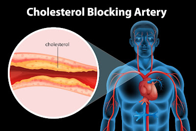 how-to-control-cholesterol-natural-strategies-to-lower-cholesterol