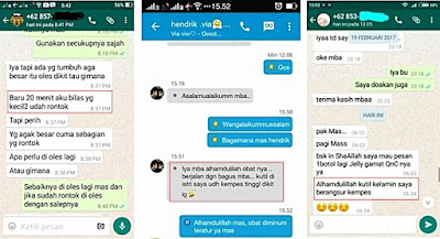 Cara Menghilangkan Skin Tag Atau Daging Tumbuh Di Kulit Leher