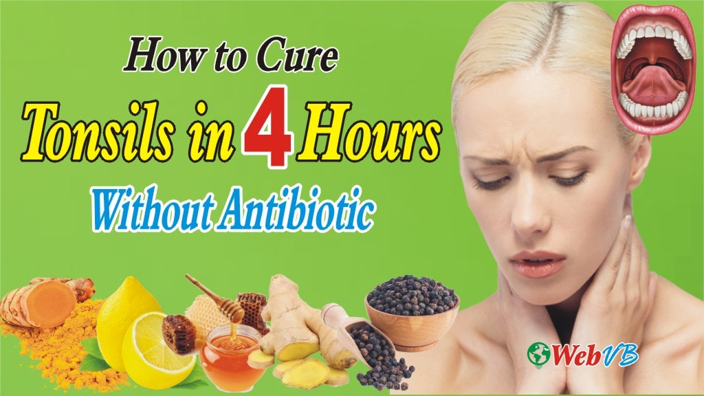 How to Cure Tonsillitis in 4 Hours Without Antibiotics