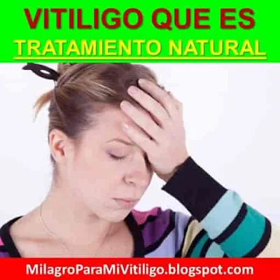 vitiligo-que-es-como-empieza-enfermedad-piel