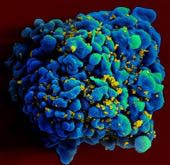 virus HIV membunuh sel kekebalan sel T