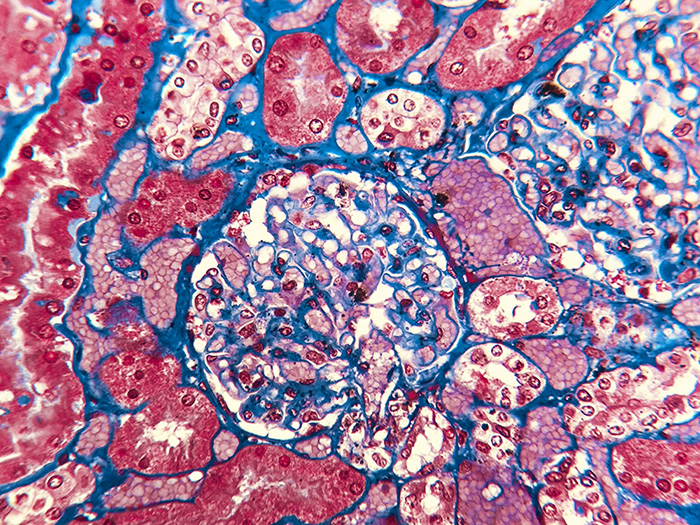 Slide Histologi Ginjal Pewarnaan Masson Trikrom: Penting untuk Penelitian Jaringan