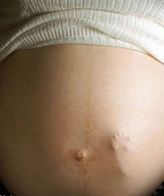 El Embarazo No Dura 9 Meses Todo Sobre El Bebe