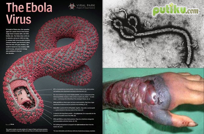 Pengertian dan Gejala Virus Ebola yang Mematikan  PUTIKU 