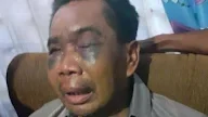 Kuli Bangunan Bonyok Disiksa Polisi di Sel Tahanan, Dipaksa Ngaku Jadi Tersangka Pembunuhan