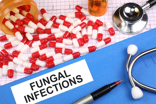 8 Tips to Prevent Fungal Infections
