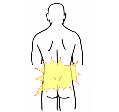 筋筋膜性腰痛　神戸やすらぎ訪問マッサージ