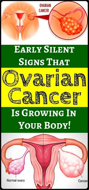 7 Ovarian Cancer Signs That Can Be Easily Missed