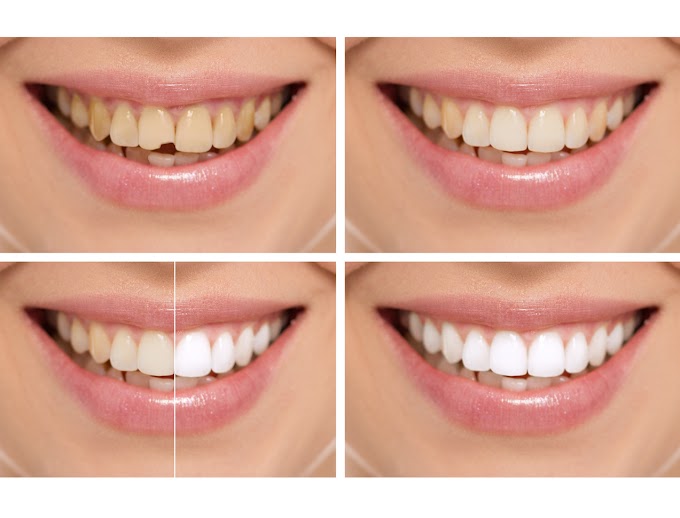 Multispeciality Dental Clinic New Delhi for Smile Makeover  