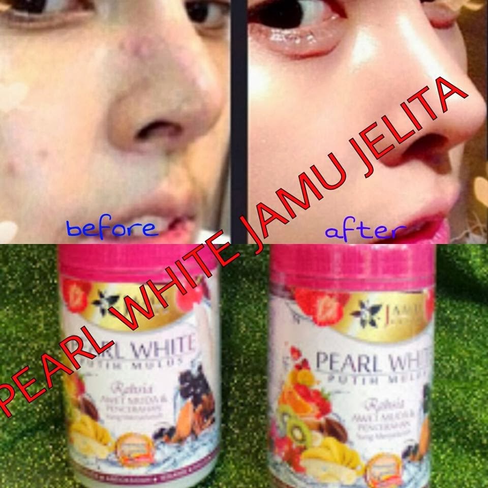 ZainieshaShop2u: Pearl White Jamu Jelita (Untuk Kulit ...