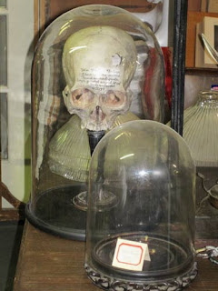 Skull Fracture Under Glass.