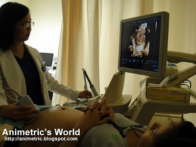 3D / 4D Ultrasound at The Medical City WHC
