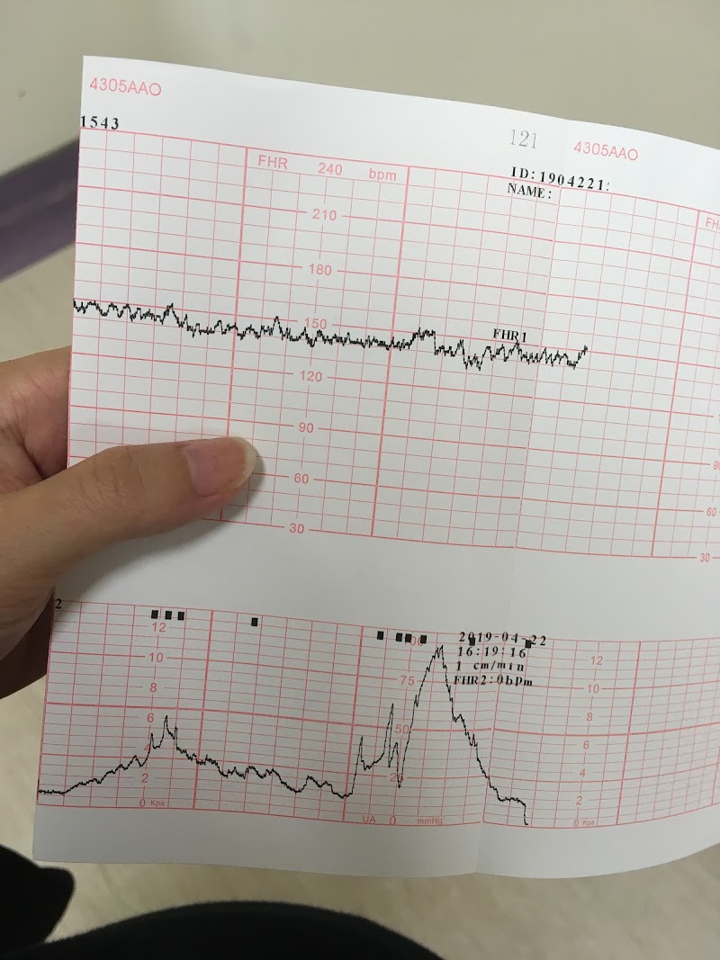 產檢∥健保扣打用完了... 來測量胎心音