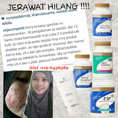 Set Vitamin Untuk Masalah Kulit Berjerawat : Merawat Masalah Jerawat Dari Dalam 