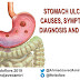 STOMACH ULCER: CAUSES, SYMPTOMS, DIAGNOSIS AND CURE 