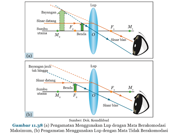 Gambar (a) Pengamatan Menggunakan Lup dengan Mata Berakomodasi Maksimum, (b) Pengamatan Menggunakan Lup dengan Mata Tidak Berakomodasi