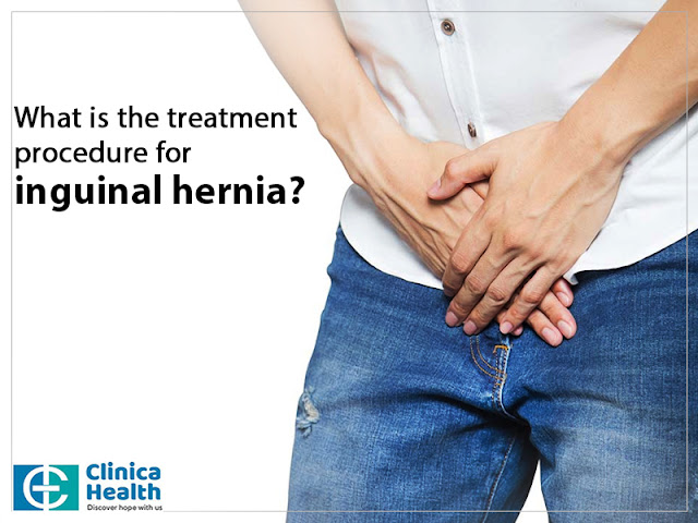 hernia surgery