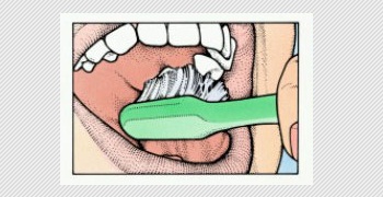merawat gigi geraham