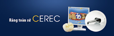 Phục hình răng sứ Cerec cho răng hàm cần biết