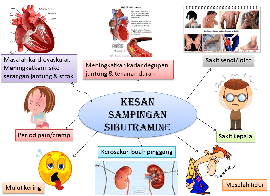 Ubat Kurus Selamat Dan Berkesan - Foto Fros