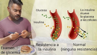 DIABETES-TIPO-2-QUE-ES-DIABETES-QUE-CAUSA-DIABETES-SINTOMAS-DE-DIABETES