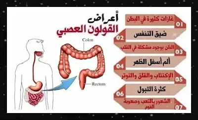 ما هي أعراض مرض القولون العصبي؟