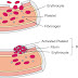 Understanding the Process of Coagulation: How Blood Clots Form