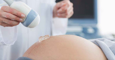 Ultrasound gel is a conductive medium that bonds the skin to the ultrasound transducer.