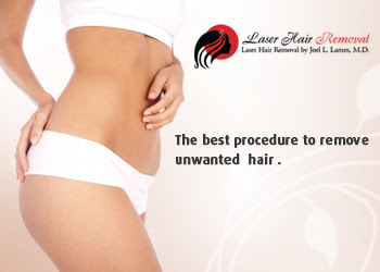 laser hair removal treatments