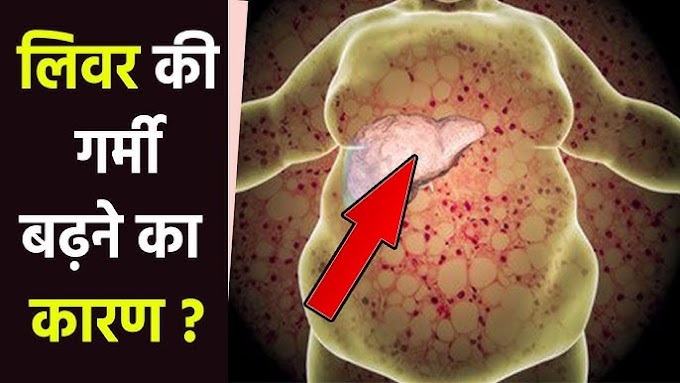 लीवर हीट के लक्षण और कारण: पूरी जानकारी।