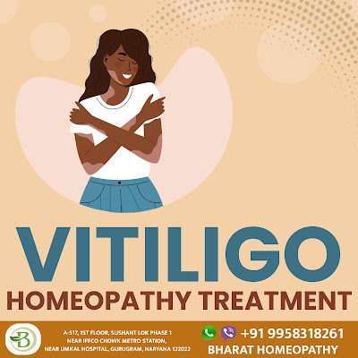 vitiligo treatment by Bharat Homeopathy