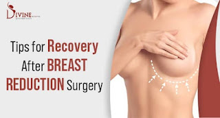Breast Reduction Recovery Tips After Surgery