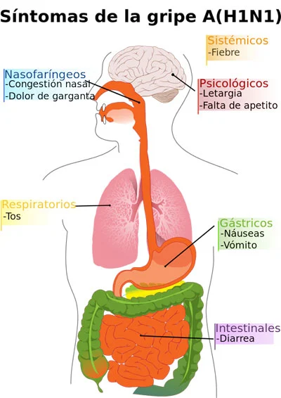 Diagrama de síntomas de la gripe