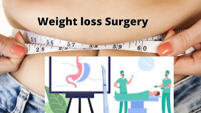 Weight loss Surgery-NHS